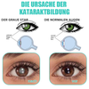 VisionDew™ Refreshes Tired Eyes