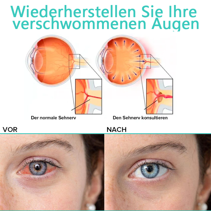 VisionDew™ Refreshes Tired Eyes