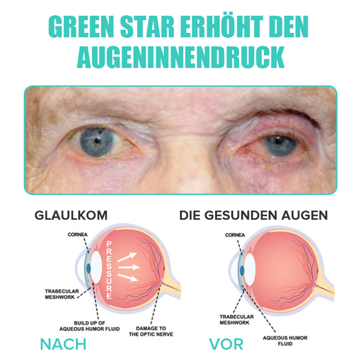 VisionDew™ Refreshes Tired Eyes