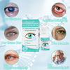 VisionDew™ Refreshes Tired Eyes