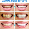 Whitening Toothpaste with Niacinamide & Probiotics | Fresh Breath & Gum Care | FreshGleam