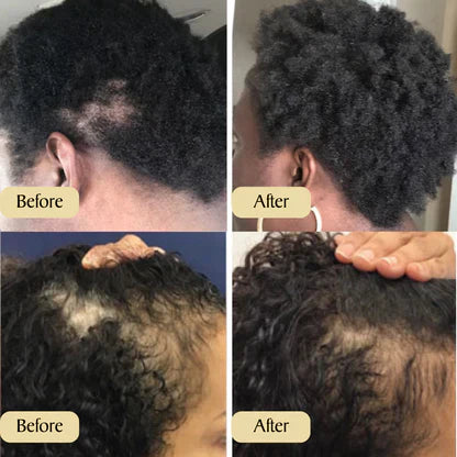 HairRevive™ Your Natural Oil Treatment for Hair Growth