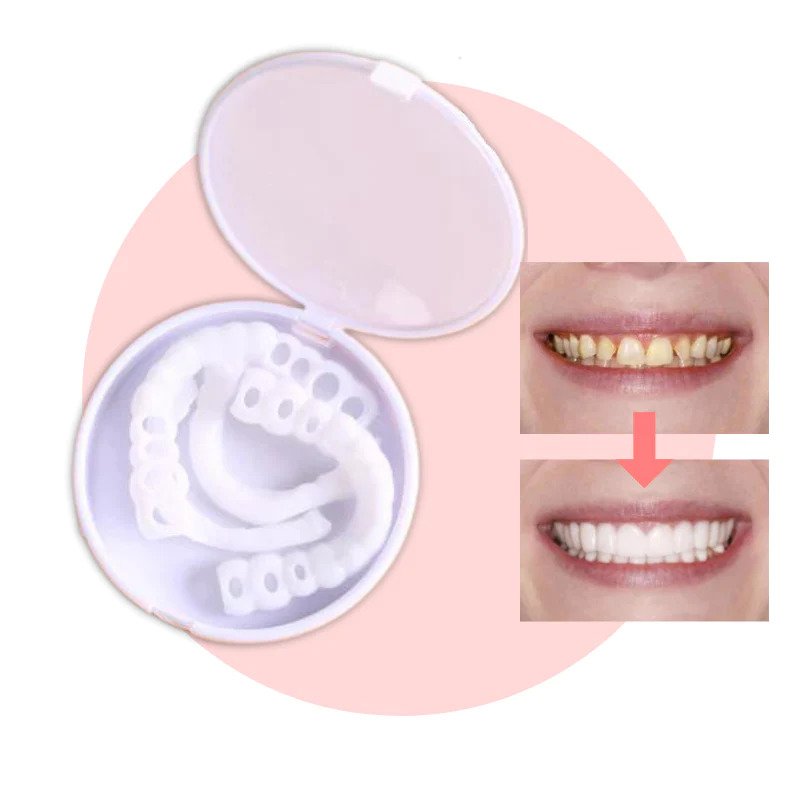 Snap-on Teeth™ - With these veneers, always have the perfect smile