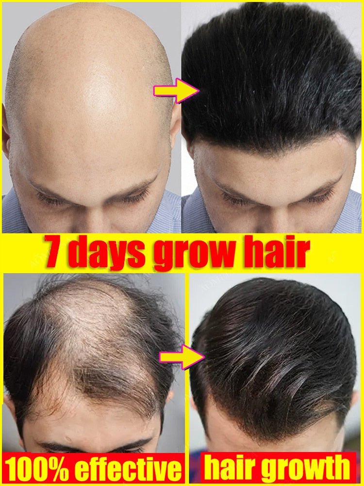 Hair Growth Oil