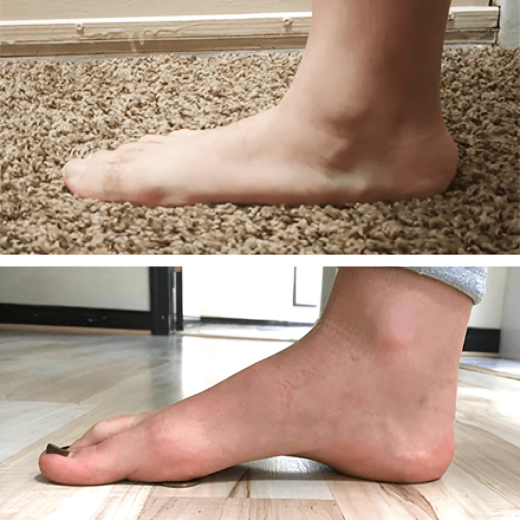 1+1 Free | StepComfort™ Soothing Foot Relief