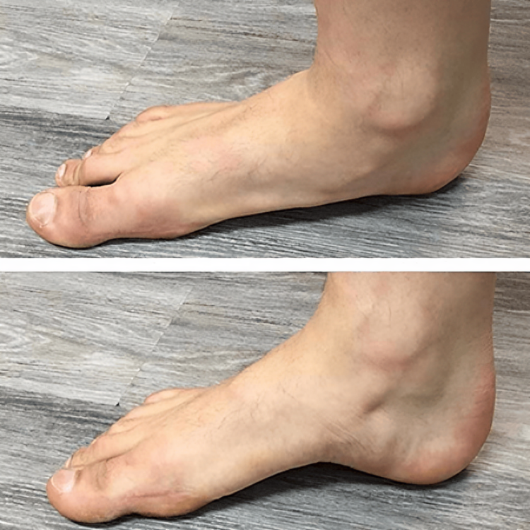 1+1 Free | StepComfort™ Soothing Foot Relief