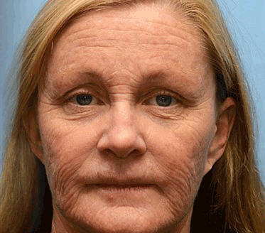 Firming Face Cream | FirmTouch™ Smooth Skin Boost | Wrinkle Reduction | Deep Hydration | 2+2 Free Offer