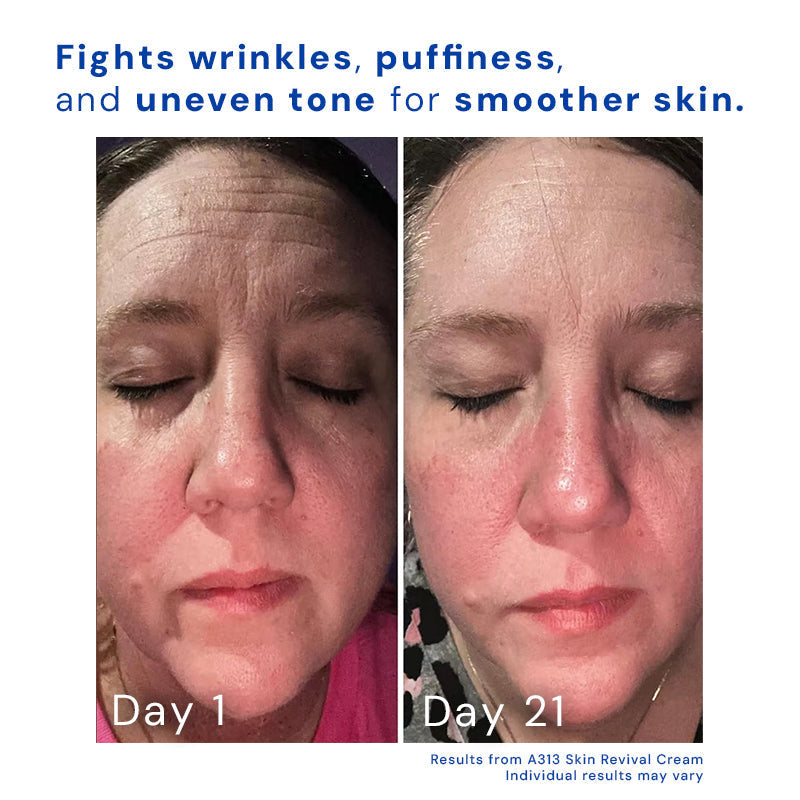 Anti-Aging Night Cream | Retinyl Palmitate & Vitamin A | Smooth Wrinkle Repair | Hydrating Formula