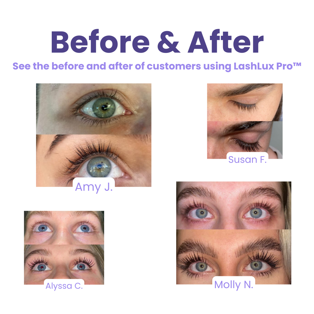 1+1 Free | LashLux Pro™ - Eyelash Growth Serum