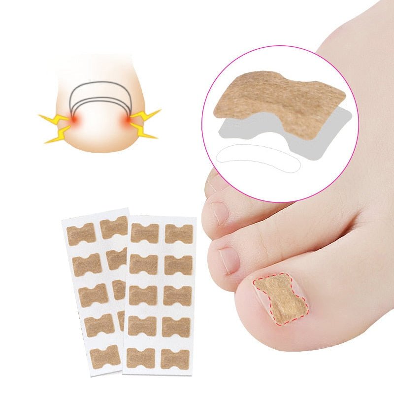 Painless Toenail Patch - ToenailExpress™