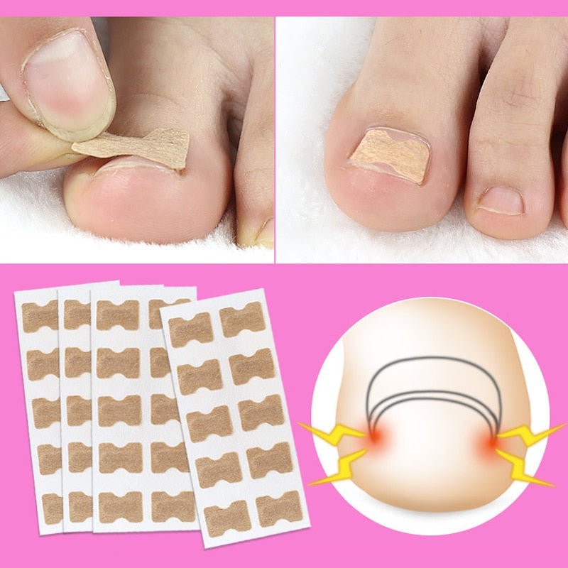 Painless Toenail Patch - ToenailExpress™