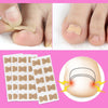 Painless Toenail Patch - ToenailExpress™