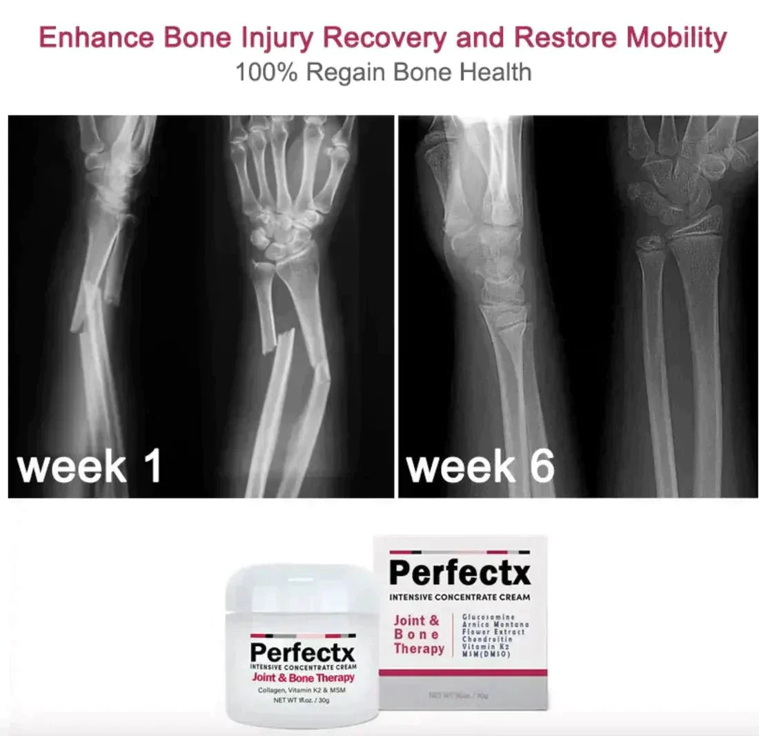 Perfectx Joint And Bone Therapy Cream