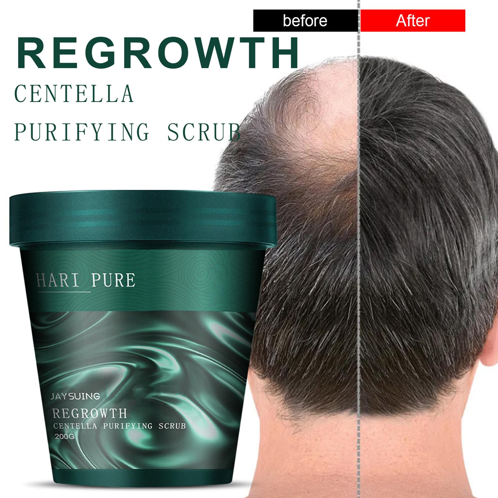 ( 1+ 1 FREE ) Regrowth & Anti-dandruff Shampoo