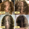 HairRevive™ Your Natural Oil Treatment for Hair Growth