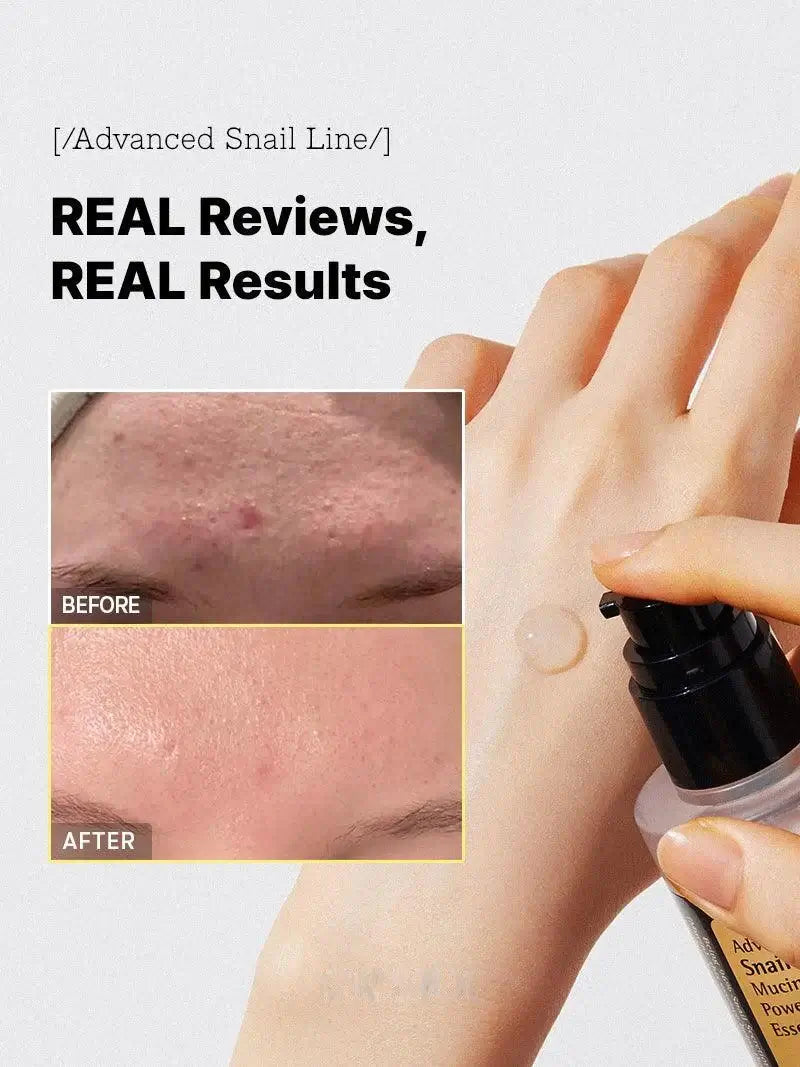 Face Serum | Snail Mucin Hydrating & Repairing Formula | Anti-Aging & Brightening | 30ml