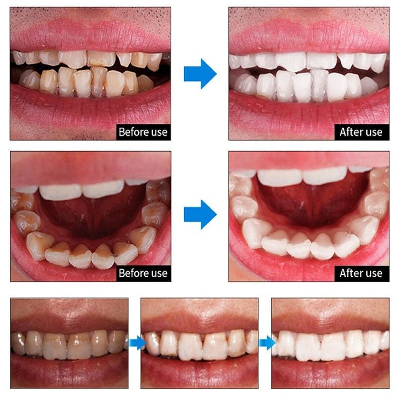 Teeth Whitening Mousse Toothpaste